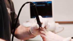 Morton's Neuroma Cryosurgery