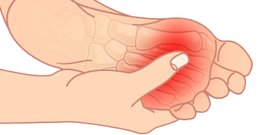 Morton's Neuroma and Bursal Complex.