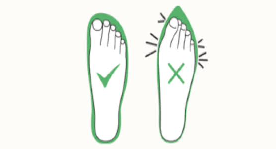 intermetatarsal bursitis