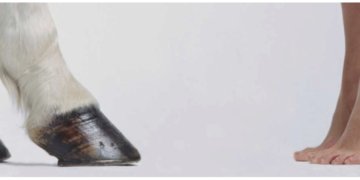 Ankle Equinus and Morton’s Neuroma